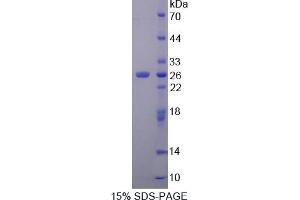 Image no. 1 for Suppressor of Cytokine Signaling 2 (SOCS2) (AA 1-198) protein (His tag) (ABIN6238101) (SOCS2 Protein (AA 1-198) (His tag))