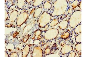 Immunohistochemistry of paraffin-embedded human thyroid tissue using ABIN7154818 at dilution of 1:100 (HDHD2 antibody  (AA 97-249))