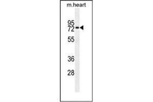 Western blot analysis of Otopetrin-1 Antibody (Center) in mouse heart tissue lysates (35ug/lane). (Otopetrin 1 antibody  (Middle Region))