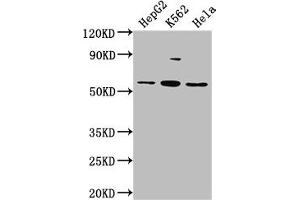 Western Blot Positive WB detected in: HepG2 whole cell lysate, K562 whole cell lysate, Hela whole cell lysate All lanes: ADRA1A antibody at 1:2000 Secondary Goat polyclonal to rabbit IgG at 1/50000 dilution Predicted band size: 52, 53, 48, 51, 33, 38, 36, 41 kDa Observed band size: 52 kDa (alpha 1 Adrenergic Receptor antibody  (AA 6-22))