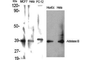 Western Blot (WB) analysis of specific cells using Aldolase B Polyclonal Antibody. (ALDOB antibody  (Internal Region))