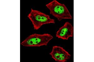 Fluorescent image of  cells stained with IL18 Antibody (C-term) .