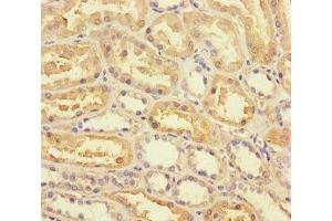 Immunohistochemistry of paraffin-embedded human kidney tissue using ABIN7163422 at dilution of 1:100 (ANKRD33 antibody  (AA 1-272))