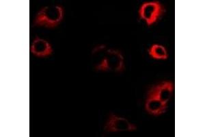 Immunofluorescent analysis of Kinesin 2 staining in SW480 cells. (KIF2A antibody)