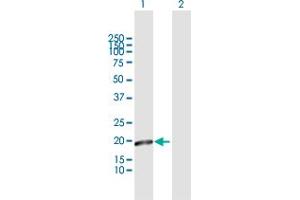 Western Blot analysis of MTP18 expression in transfected 293T cell line by MTP18 MaxPab polyclonal antibody.