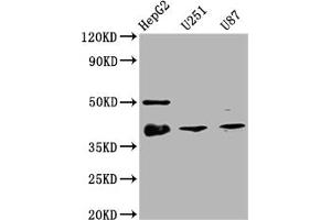 Western Blot Positive WB detected in: HepG2 whole cell lysate, U251 whole cell lysate, U87 whole cell lysate All lanes: TTF1 antibody at 1:2000 Secondary Goat polyclonal to rabbit IgG at 1/50000 dilution Predicted band size: 39 kDa Observed band size: 39 kDa (Recombinant NKX2-1 antibody)
