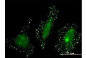 Immunofluorescence of monoclonal antibody to PKN2 on HeLa cell. (PKN2 antibody  (AA 580-679))