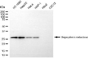Western blotting analysis using sepiapterin reductase antibody (ABIN7800294).