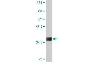 Western Blot detection against Immunogen (37. (NEK4 antibody  (AA 680-781))