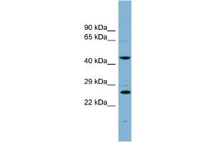 WB Suggested Anti-VPS28 Antibody Titration: 0.