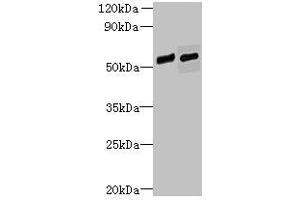 Western blot All lanes: FAM124B antibody at 12 μg/mL Lane 1: Hela whole cell lysate Lane 2: K562 whole cell lysate Secondary Goat polyclonal to rabbit IgG at 1/10000 dilution Predicted band size: 51, 32 kDa Observed band size: 51 kDa (FAM124B antibody  (AA 146-272))