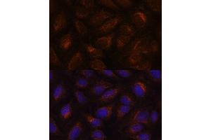 Immunofluorescence analysis of U-2 OS cells using  antibody (ABIN6131176, ABIN6136646, ABIN6136647 and ABIN6222857) at dilution of 1:100. (AGR2 antibody  (AA 21-175))