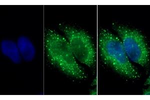 Detection of HADH in Human HepG2 cell using Polyclonal Antibody to Hydroxyacyl Coenzyme A Dehydrogenase (HADH) (HADH antibody  (AA 1-236))