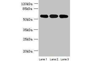 Western blot All lanes: STK33 antibody at 4 μg/mL Lane 1: Mouse kidney tissue Lane 2: Hela whole cell lysate Lane 3: Jurkat whole cell lysate Secondary Goat polyclonal to rabbit IgG at 1/10000 dilution Predicted band size: 58, 51 kDa Observed band size: 58 kDa (STK33 antibody  (AA 231-514))