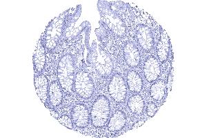 Complete absence of AR staining in normal colon mucosa (Recombinant Androgen Receptor antibody  (AA 1-100))