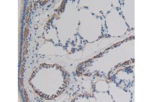 Used in DAB staining on fromalin fixed paraffin- embedded lung tissue (UBA7 antibody  (AA 249-517))