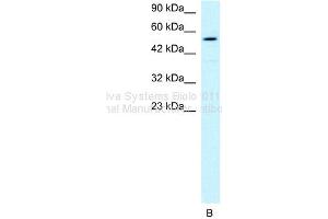 WB Suggested Anti-HLX1 Antibody Titration: 1ug/mlPositive Control: HepG2 cell lysate (HLX antibody  (Middle Region))