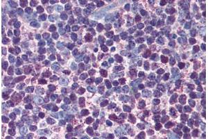 Human Thymus (formalin-fixed, paraffin-embedded) stained with CASP3 antibody ABIN305732 at 5 ug/ml followed by biotinylated anti-mouse IgG secondary antibody ABIN481714, alkaline phosphatase-streptavidin and chromogen. (Caspase 3 antibody)