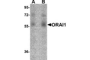 Western Blotting (WB) image for anti-ORAI Calcium Release-Activated Calcium Modulator 1 (ORAI1) antibody (ABIN1031711) (ORAI1 antibody)