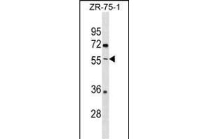 ENTPD5 Antibody (C-term) (ABIN1537153 and ABIN2838297) western blot analysis in ZR-75-1 cell line lysates (35 μg/lane). (ENTPD5 antibody  (C-Term))