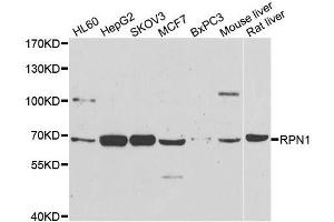 Western blot analysis of extracts of various cell lines, using RPN1 antibody. (RPN1 antibody  (AA 20-280))