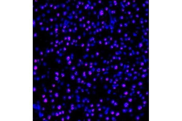 PPP4R2 antibody