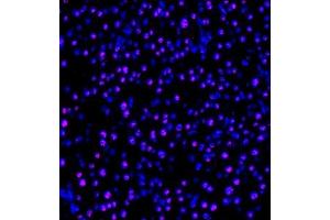 Immunofluorescence of paraffin embedded mouse pancreas using PP4R2 (ABIN7075284) at dilution of 1:1000 (400x lens) (PPP4R2 antibody)