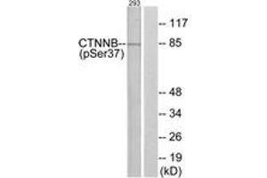 Western blot analysis of extracts from 293 cells, using Catenin-beta (Phospho-Ser37) Antibody. (beta Catenin antibody  (pSer37))