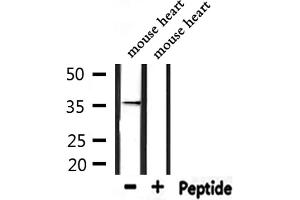 Western blot analysis of extracts from mouse heart, using TAS2R9 Antibody.