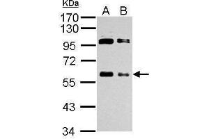 WB Image Sample (whole cell lysate) A: 293T 20ug B: 293T 10ug 10% SDS PAGE antibody diluted at 1:1000 (c-MYC antibody  (Center))