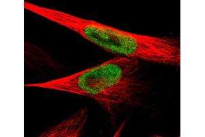 Immunofluorescent staining of human cell line U-251 MG shows localization to nucleoplasm.