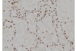 ABIN6275651 at 1/100 staining Human  tissue by IHC-P. (USP13 antibody  (C-Term))