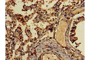 Immunohistochemistry of paraffin-embedded human lung tissue using ABIN7145950 at dilution of 1:100 (CCL13 antibody  (AA 17-81))