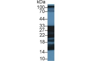 Western Blot; Sample: Porcine Cerebrum lysate; Primary Ab: 1µg/ml Rabbit Anti-Human SNAP25 Antibody Second Ab: 0.