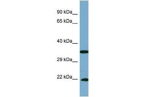 Host:  Rabbit  Target Name:  SLC6A6  Sample Type:  PANC1 Whole cell lysates  Antibody Dilution:  1. (TAUT antibody  (C-Term))