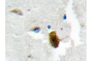 Immunohistochemistry analyzes of MgcRacGAP antibody in paraffin-embedded human brain tissue. (RACGAP1 antibody)