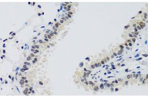 Immunohistochemistry of paraffin-embedded Mouse lung using CCNE2 Polyclonal Antibody at dilution of 1:100 (40x lens). (Cyclin E2 antibody)
