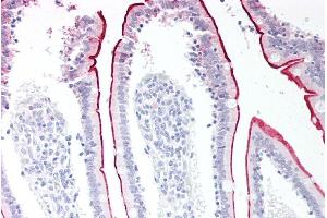 ABIN185111 (5µg/ml) staining of paraffin embedded Human Small Intestine. (VPS45 antibody  (C-Term))