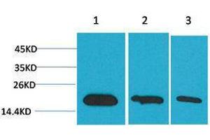 Western Blotting (WB) image for anti-Baculoviral IAP Repeat-Containing 5 (BIRC5) antibody (ABIN3179085) (Survivin antibody)