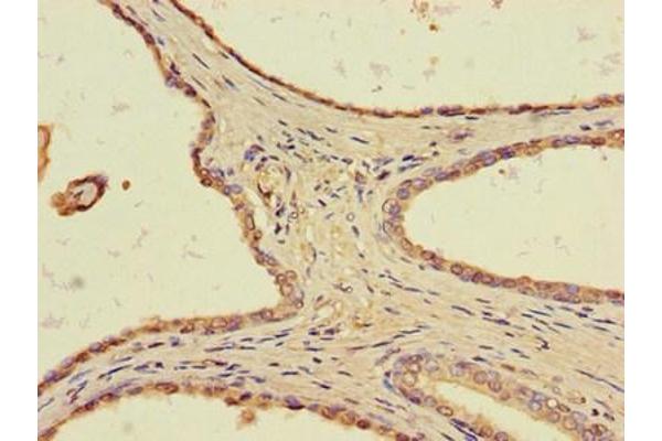 TLL1 antibody  (AA 522-643)