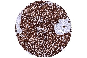 Liver In the liver a strong cytoplasmic staining of all bile ductal epithelial cells and an at least moderate predominantly membranous immunostaining of hepatocytes is seen (Recombinant pan Keratin antibody)