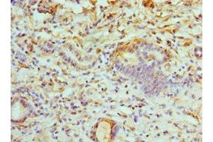 Immunohistochemistry of paraffin-embedded human kidney tissue using ABIN7175230 at dilution of 1:100 (ATP6V1B1 antibody  (AA 1-280))