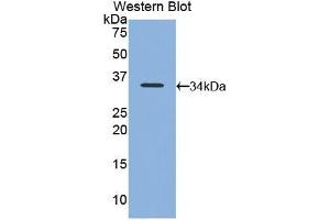 Detection of Recombinant NB1, Mouse using Polyclonal Antibody to Neutrophil Specific Antigen 1 (NB1) (CD177 antibody  (AA 193-468))