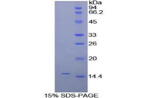 SDS-PAGE analysis of Human alpha Galactosidase Protein. (GLA Protein)