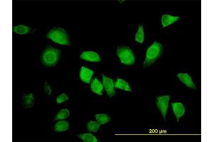 Immunofluorescence of monoclonal antibody to LZTFL1 on HeLa cell. (LZTFL1 antibody  (AA 200-299))