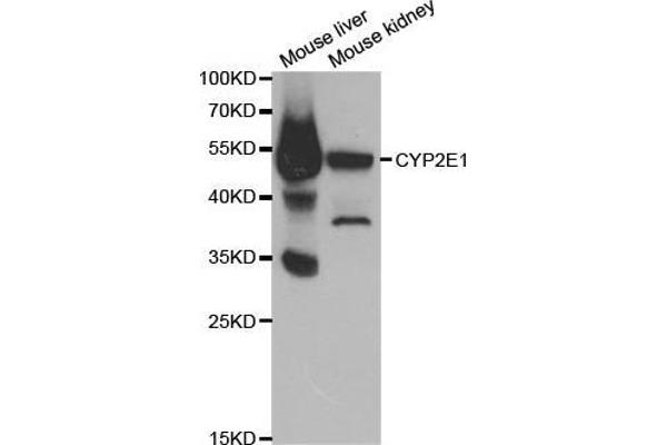 CYP2E1 antibody  (AA 234-493)