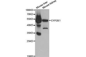 Western blot analysis of extracts of various cell lines, using CYP2E1 antibody.