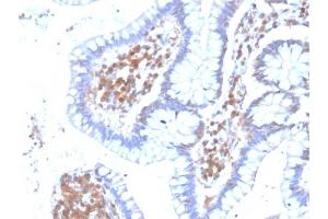 Formalin-fixed, paraffin-embedded human Colon stained with MAPK14 Mouse Monoclonal Antibody (CPTC-MAPK14-1). (MAPK14 antibody)