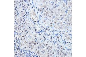 Immunohistochemistry of paraffin-embedded rat ovary using DGCR8 Rabbit pAb (ABIN7266761) at dilution of 1:200 (40x lens). (DGCR8 antibody)