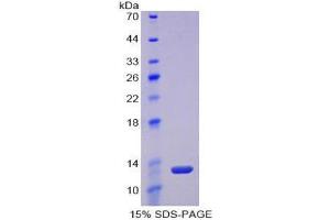 SDS-PAGE (SDS) image for Lysyl Oxidase-Like 2 (LOXL2) (AA 53-160) protein (His tag) (ABIN2121576) (LOXL2 Protein (AA 53-160) (His tag))